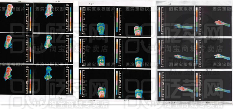 砭石學(xué)堂：泗濱砭石的作用和功效圖8