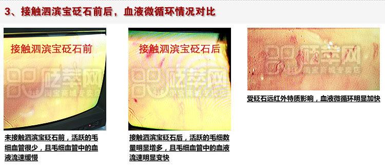 砭石學(xué)堂：泗濱砭石對人體甲襞微循環(huán)血流速度影響的定量檢測圖12