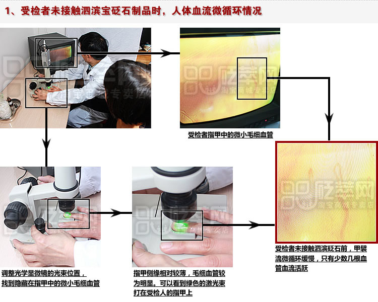 砭石學(xué)堂：泗濱砭石對人體甲襞微循環(huán)血流速度影響的定量檢測圖4